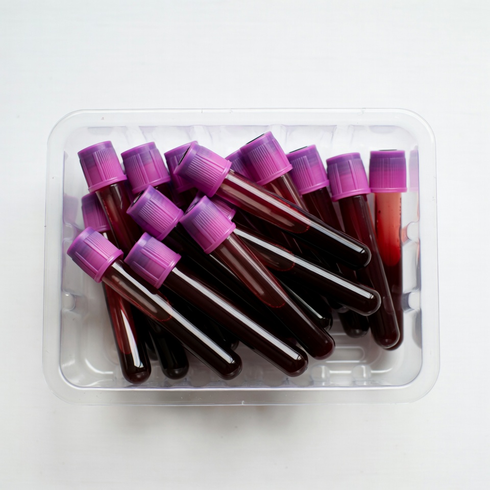 Blood sample tubes in tray Blood sample tubes in tray