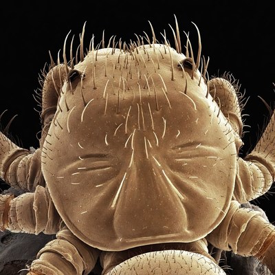 Close-up view of a microscopic creature