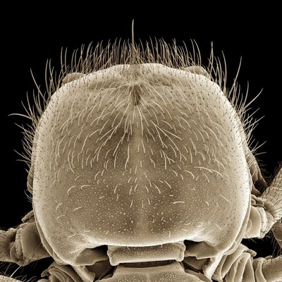Close-up view of insect features under microscope