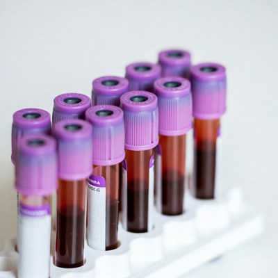 Purple blood sample tubes in rack