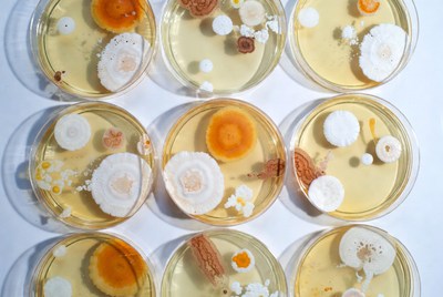 Petri Dishes with Bacterial Colonies