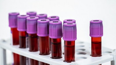 Blood sample tubes in rack