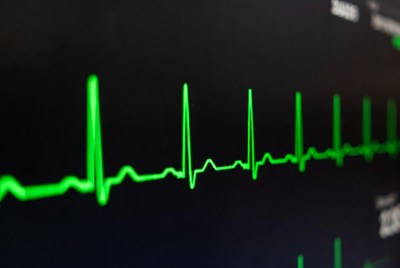 Green ECG Heart Monitor Wave