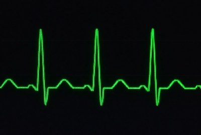 Green ECG Heartbeat Line