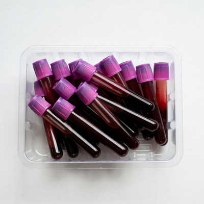 Blood sample tubes in tray