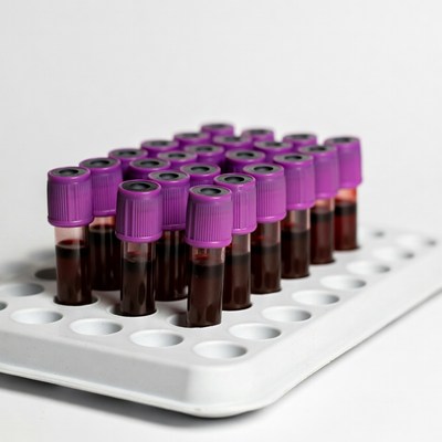 Purple Top Blood Tubes in Rack