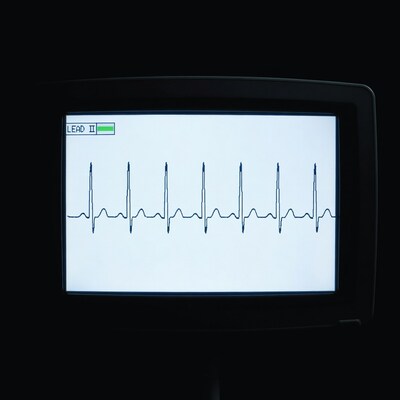 ECG Monitor Lead II Heartbeat