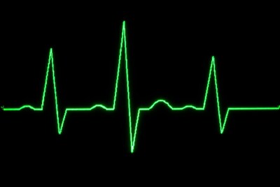 Green Heartbeat Line on Black Background