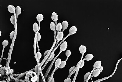 Yeast cells SEM micrograph