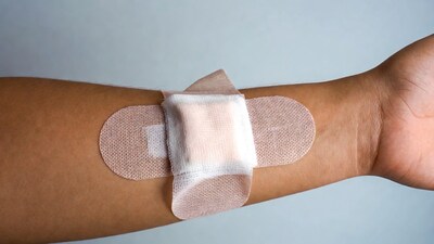 Bandage on arm