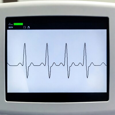 ECG Monitor Screen with Heartbeat
