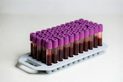 Purple-top blood tubes in rack