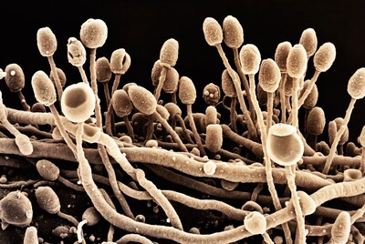 SEM image of fungal spores and hyphae