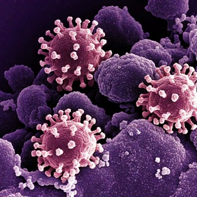 Colorized SEM coronaviruses cluster