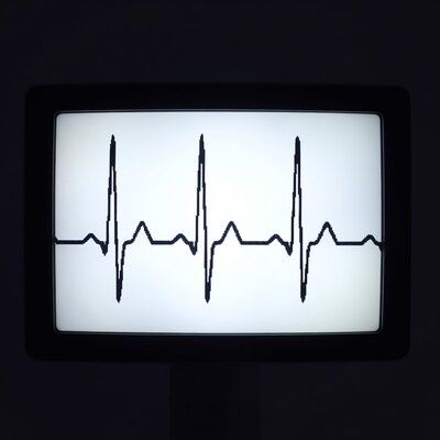ECG Heart Monitor Screen