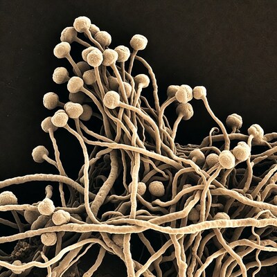 SEM image of fungal hyphae and spores